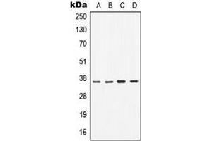 Western blot analysis of CD1b expression in H1299 (A), Jurkat (B), Raw264. (CD1b antibody  (Center))