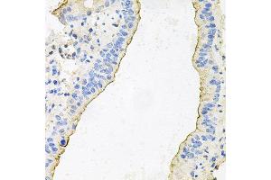 Immunohistochemistry of paraffin-embedded mouse lung using HPR antibody at dilution of 1:100 (x40 lens). (HPR antibody)