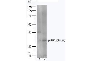 Lane 1: HeLa lysates Lane 2: Mouse spleen lysates probed with Rabbit Anti-RPA2(Thr21) Polyclonal Antibody, Unconjugated (ABIN713351) at 1:300 overnight at 4 °C. (RPA2 antibody  (pThr21))