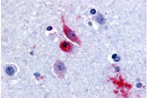 Human Brain, Caudate (formalin-fixed, paraffin-embedded) stained with GPR61 antibody ABIN213520 at 15-30 ug/ml followed by biotinylated goat anti-rabbit IgG secondary antibody ABIN481713, alkaline phosphatase-streptavidin and chromogen. (GPR61 antibody  (Extracellular Domain))