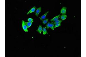 Immunofluorescent analysis of PC-3 cells using ABIN7149804 at dilution of 1:100 and Alexa Fluor 488-congugated AffiniPure Goat Anti-Rabbit IgG(H+L) (DDA1 antibody  (AA 1-102))