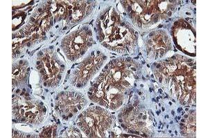 Image no. 6 for anti-V-Akt Murine Thymoma Viral Oncogene Homolog 1 (AKT1) antibody (ABIN1496557) (AKT1 antibody)