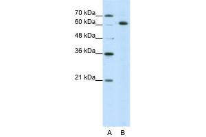 WB Suggested Anti-SNRP70 Antibody Titration:  5. (SNRNP70 antibody  (N-Term))