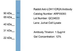 WB Suggested Anti-LOH11CR2A  Antibody Titration: 0. (VWA5A antibody  (N-Term))