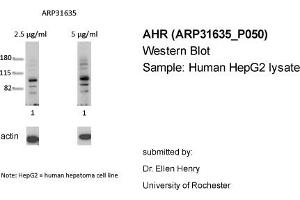 Western Blotting (WB) image for anti-Aryl Hydrocarbon Receptor (AHR) (N-Term) antibody (ABIN2777386) (Aryl Hydrocarbon Receptor antibody  (N-Term))