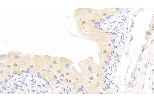 Detection of MMP13 in Rabbit Bladder Tissue using Polyclonal Antibody to Matrix Metalloproteinase 13 (MMP13) (MMP13 antibody  (AA 70-245))