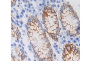 #VALUE! (B3GALT5 antibody  (AA 29-310))