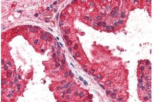 Human Prostate (formalin-fixed, paraffin-embedded) stained with CREB3L4 antibody ABIN337002 at 2. (CREB3L4 antibody  (AA 382-395))