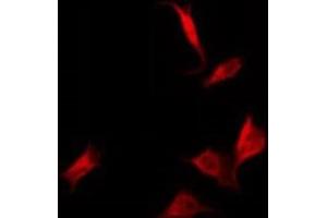 ABIN6278555 staining Hela by IF/ICC. (CYB561D2 antibody)