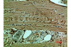 Immunohistochemical analysis of paraffin-embedded human-muscle, antibody was diluted at 1:200 (COL12A1 antibody  (AA 1268-1341))