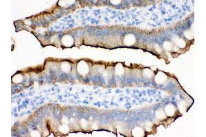 Anti- Villin Picoband antibody,IHC(P) IHC(P): Rat Intestine Tissue (Villin 1 antibody  (C-Term))