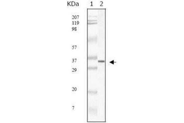 SARS-Coronavirus Membrane Protein (SARS-CoV M) antibody