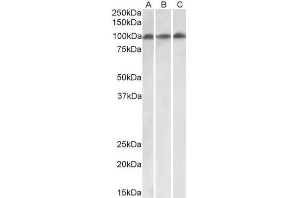VPS16 antibody  (Internal Region)