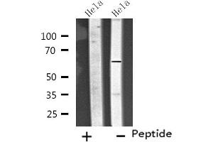 Western blot analysis of extracts from Hela cells, using CP26C antibody. (CYP26C1 antibody  (Internal Region))