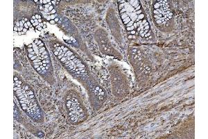 IHC analysis of INPPL1 using anti-INPPL1 antibody (ABIN7599785).
