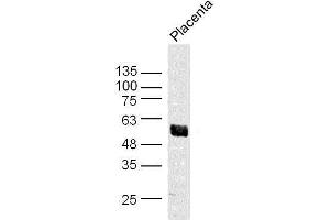 Mouse placenta lysates probed with Akt1/3 Polyclonal Antibody, unconjugated  at 1:300 overnight at 4°C followed by a conjugated secondary antibody at 1:10000 for 90 minutes at 37°C. (AKT1/3 (AA 401-479) antibody)