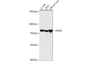 Western blot analysis of extracts of various cell lines, using EPB42 antibody (ABIN7267007) at 1:1000 dilution. (EPB42 antibody  (AA 10-240))