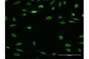 Immunofluorescence of monoclonal antibody to RBM5 on HeLa cell.