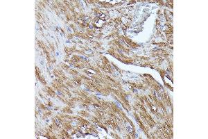 Immunohistochemistry of paraffin-embedded mouse heart using N-WASP/WASL antibody (ABIN3016273, ABIN3016274, ABIN3016275, ABIN1683282 and ABIN6219682) at dilution of 1:100 (40x lens).