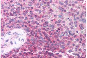 Human Spleen (formalin-fixed, paraffin-embedded) stained with TRIM32 antibody ABIN213721 at 2. (TRIM32 antibody  (AA 549-598))