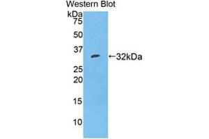 Western blot analysis of recombinant Mouse TBG. (SERPINA7 antibody  (AA 127-393))