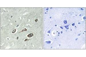 Immunohistochemistry analysis of paraffin-embedded human brain, using Calmodulin (Phospho-Thr79+Ser81) Antibody. (Calmodulin 1 antibody  (pThr79))