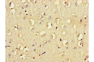 Immunohistochemistry of paraffin-embedded human brain tissue using ABIN7158541 at dilution of 1:100 (FCGR2B antibody  (AA 12-289))