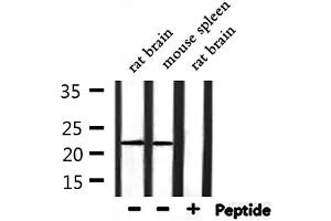 Western blot analysis of extracts from rat brain and mouse spleen, using RPL14 Antibody.