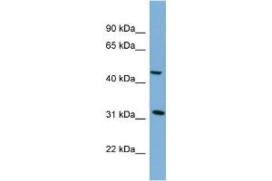 WB Suggested Anti-SERPINI2 Antibody Titration: 0. (SERPINI2 antibody  (Middle Region))