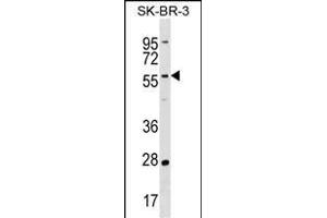 TAF6L Antibody (N-term) (ABIN1539596 and ABIN2838215) western blot analysis in SK-BR-3 cell line lysates (35 μg/lane). (TAF6L antibody  (N-Term))