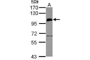 WB Image Sample (30 ug of whole cell lysate) A: HeLa 7. (UHRF1 antibody)