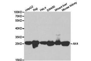 Western Blotting (WB) image for anti-Adenylate Kinase 4 (AK4) antibody (ABIN1870894) (AK4 antibody)