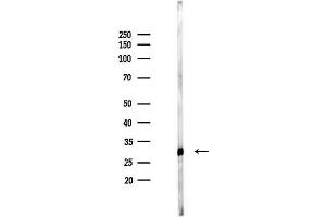 anti-Abhydrolase Domain Containing 14A (ABHD14A) (Internal Region) antibody