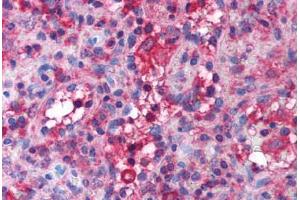 Spleen (Band 3/AE1 antibody  (AA 184-233))