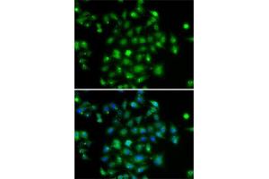 Immunofluorescence analysis of A-549 cells using DYRK2 antibody (ABIN6130879, ABIN6139897, ABIN6139898 and ABIN6222785). (DYRK2 antibody  (AA 429-528))