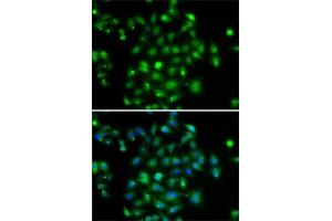 Immunofluorescence analysis of A-549 cells using DYRK2 antibody (ABIN6130879, ABIN6139897, ABIN6139898 and ABIN6222785). (DYRK2 antibody  (AA 429-528))