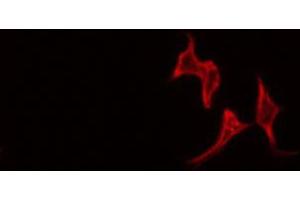 ABIN6268902 staining LOVO by IF/ICC. (MMP13 antibody  (N-Term))