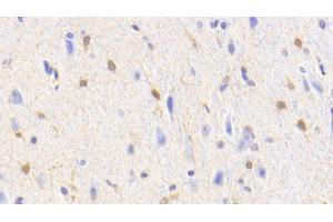 Detection of GS in Human Cerebellum Tissue using Polyclonal Antibody to Glutamine synthetase (GS) (GLN1 antibody  (AA 1-373))