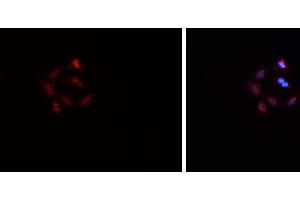 ABIN6269069 staining HepG2? (SNAIL antibody  (C-Term))