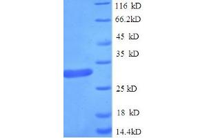 SDS-PAGE (SDS) image for Chromobox Homolog 7 (CBX7) (AA 1-251), (full length) protein (His tag) (ABIN5709211) (CBX7 Protein (AA 1-251, full length) (His tag))