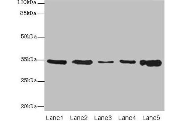 UCP3 antibody  (AA 33-76)