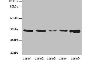 Western blot All lanes: UCP3 antibody at 0. (UCP3 antibody  (AA 33-76))