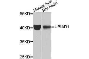 Western blot analysis of extracts of mouse liver and rat heart tissues, using UBIAD1 antibody. (UBIAD1 antibody)