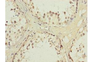 Immunohistochemistry of paraffin-embedded human testis tissue using ABIN7142330 at dilution of 1:100 (AKR1D1 antibody  (AA 1-200))