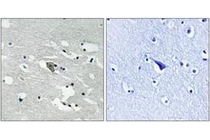 Immunohistochemistry analysis of paraffin-embedded human brain, using VEGFR1 (Phospho-Tyr1048) Antibody. (FLT1 antibody  (pTyr1048))