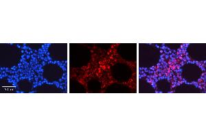 Rabbit Anti-STAT5A Antibody   Formalin Fixed Paraffin Embedded Tissue: Human Bone Marrow Tissue Observed Staining: Cytoplasm, Nucleus Primary Antibody Concentration: 1:100 Other Working Concentrations: N/A Secondary Antibody: Donkey anti-Rabbit-Cy3 Secondary Antibody Concentration: 1:200 Magnification: 20X Exposure Time: 0. (STAT5A antibody  (C-Term))