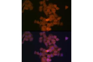 Immunofluorescence analysis of HeLa cells using PFDN5 Rabbit mAb (ABIN1682853, ABIN3018535, ABIN3018536 and ABIN7101624) at dilution of 1:100 (40x lens). (PFDN5 antibody)