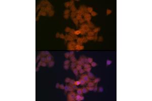 Immunofluorescence analysis of HeLa cells using PFDN5 Rabbit mAb (ABIN1682853, ABIN3018535, ABIN3018536 and ABIN7101624) at dilution of 1:100 (40x lens). (PFDN5 antibody)