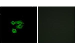 Immunofluorescence analysis of A549 cells, using LY6E Antibody. (LY6E antibody  (AA 17-66))