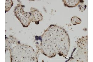 Immunoperoxidase of monoclonal antibody to ZIC4 on formalin-fixed paraffin-embedded human placenta. (ZIC4 antibody  (AA 249-319))